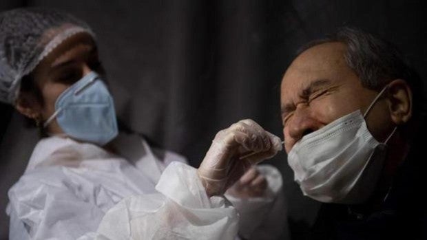 El precio de una PCR: las diferencias en el mundo