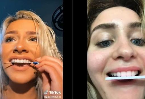 Reto viral de TikTok que consiste en limarse los dientes