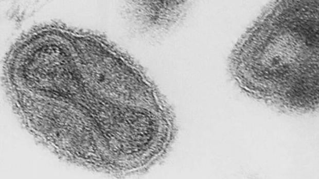 Sanidad alerta a las comunidades tras detectar ocho posibles casos de la viruela del mono