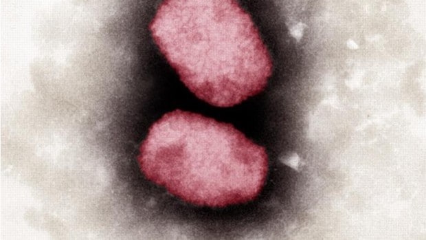 El virus visto a color desde un microscopio