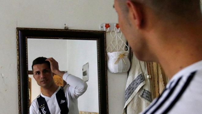 El "clon de Ronaldo presume de su parecido"