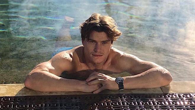 Sol, cloro, sal... En verano tu pelo sufre más que nunca