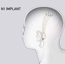 El plan de Elon Musk con su nuevo proyecto Neuralink: escuchar música en el cerebro y controlar las hormonas