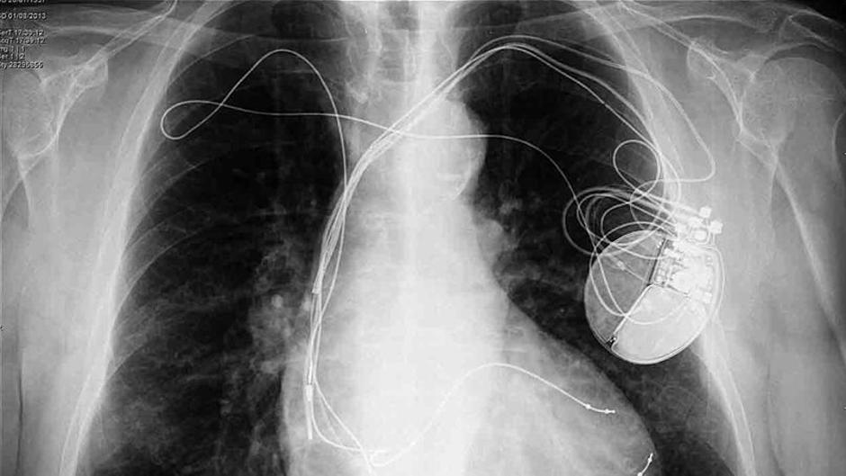 Los aparatos tecnológicos que cambiaron el mundo accidentalmente